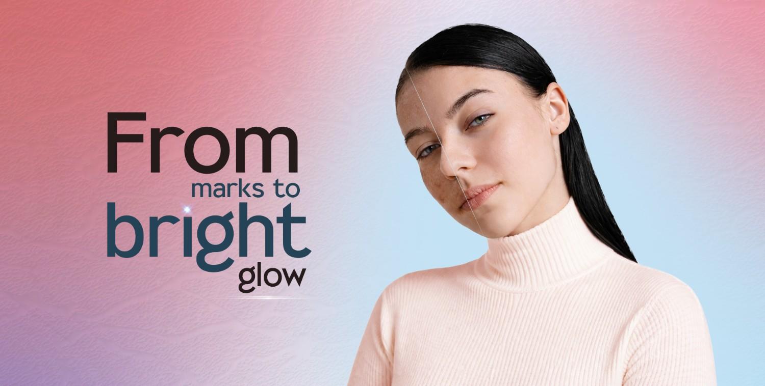 Woman's face split, showing hyperpigmentation on one side and clear, glowing skin on the other.