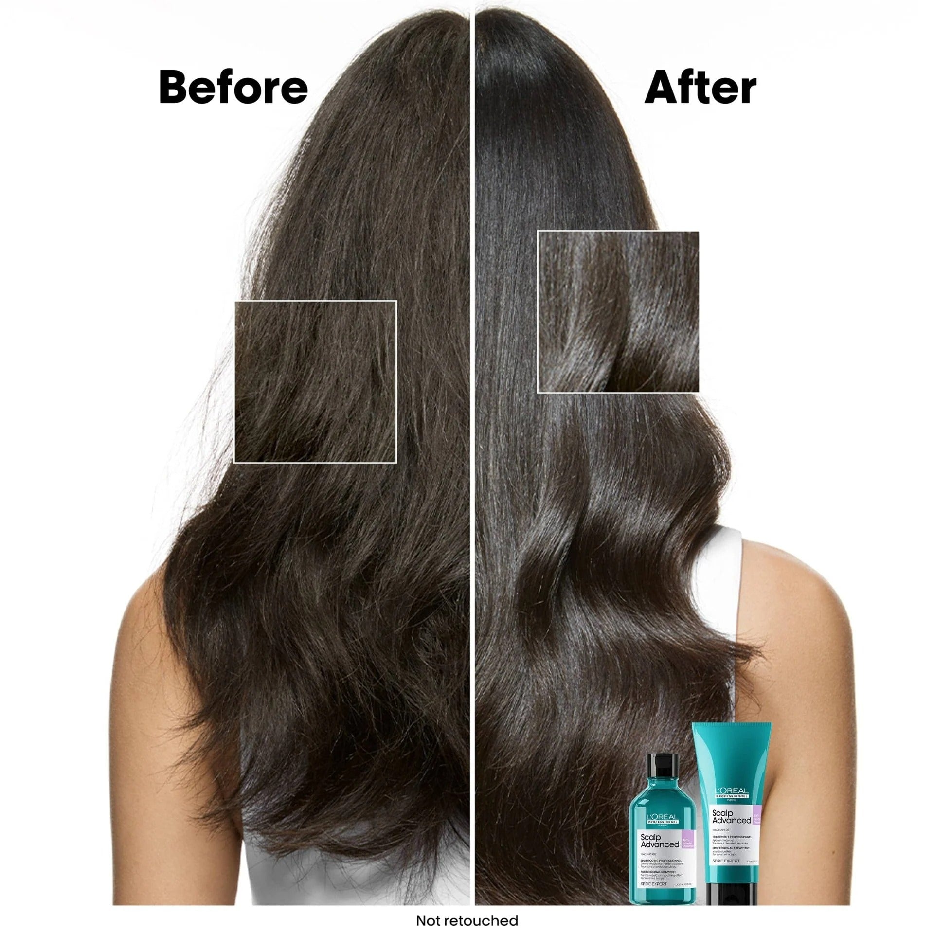 L'Oréal Professionnel Scalp Advanced Professional Shampoo Nachfüllpackung 500ml