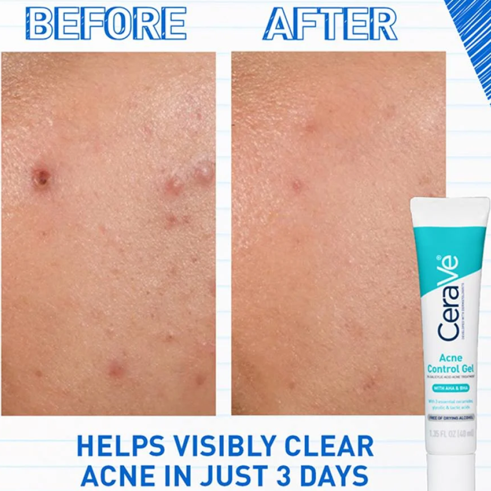 Cerave Acne Control Gel 40ml